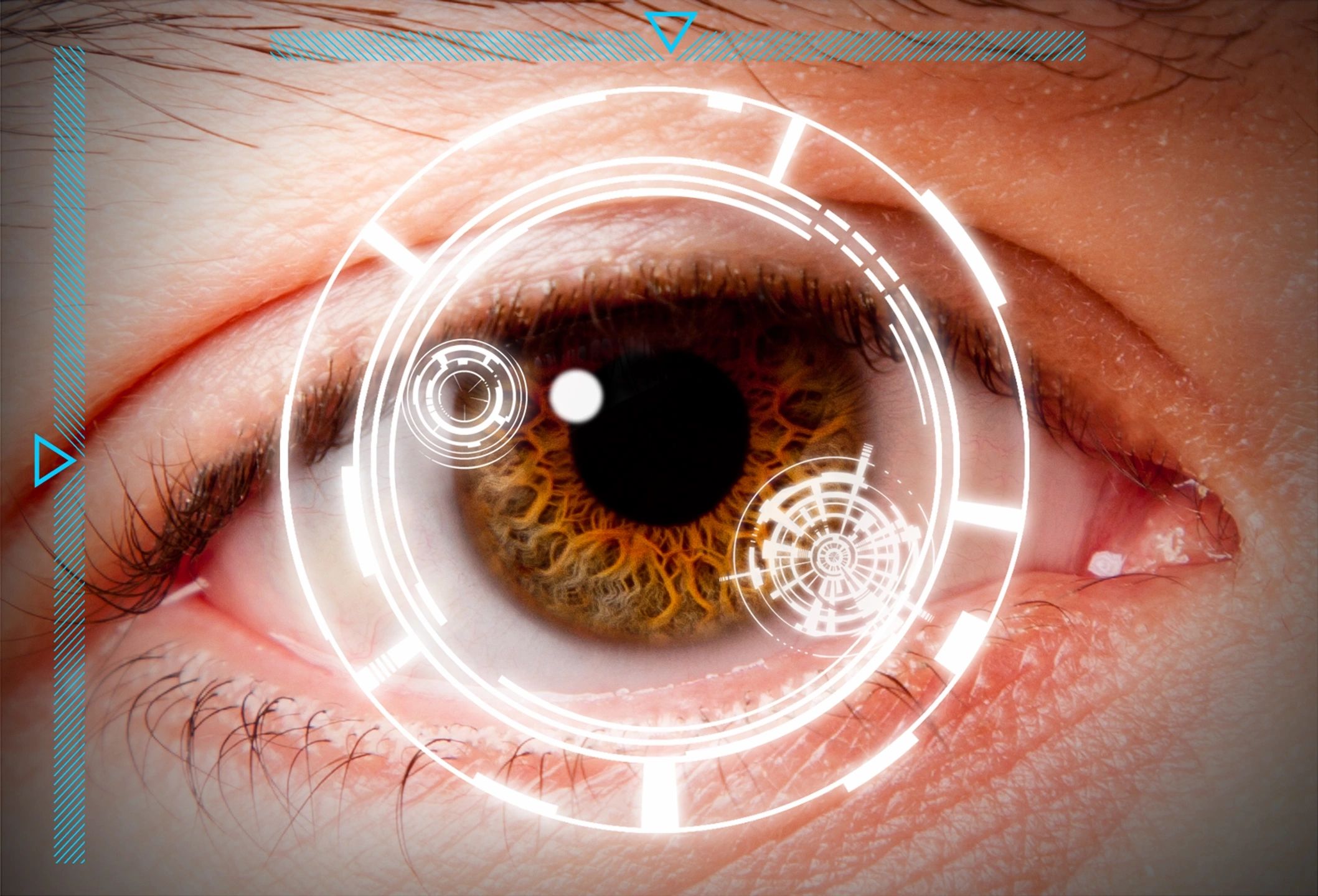 Close-up of an eye with a digital retinal scan overlay for Diabetic Retinopathy Screening